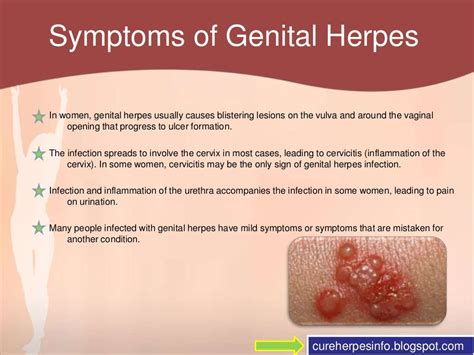 Most cases of genital herpes are caused by a virus called HSV-2. . Herpes on perineum pictures